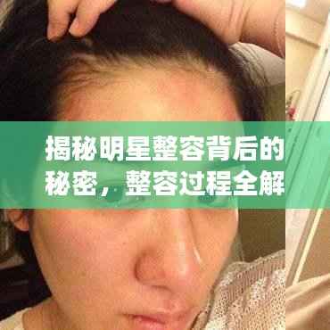 揭秘明星整容背后的秘密,整容过程全解析